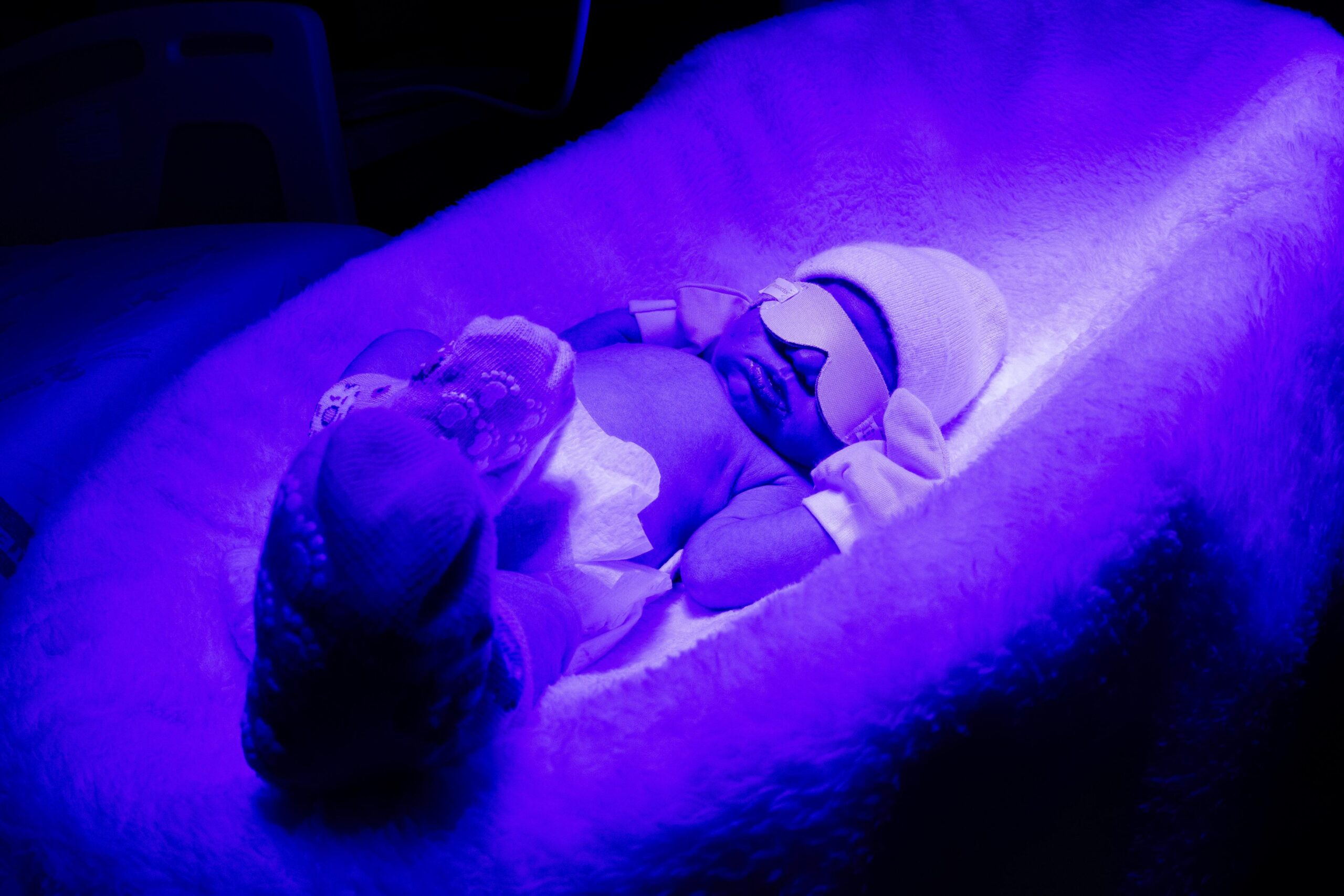 Fototerapia garante cuidado seguro aos recém-nascidos na Maternidade Nossa Senhora de Lourdes