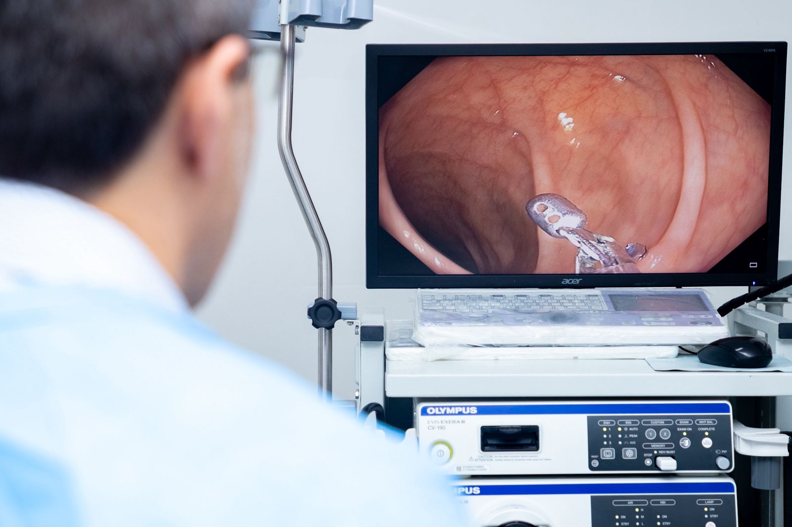 Mutirão de exames de colonoscopia fortalece combate ao câncer colorretal em Sergipe